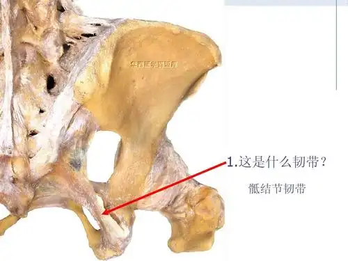 这是什么韧带? 骶结节韧带