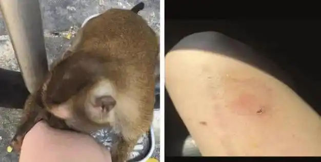 当天,新加坡也有人受袭|病毒|疱疹|猴子|野猴_网易订阅