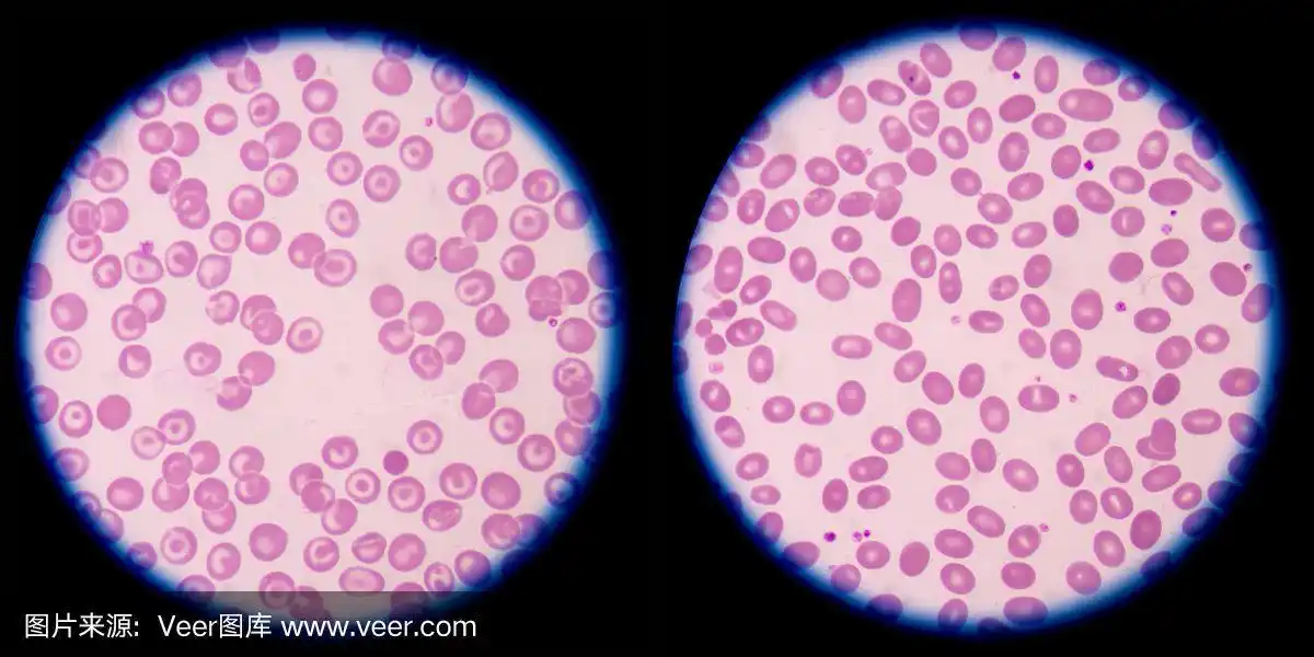 红细胞.