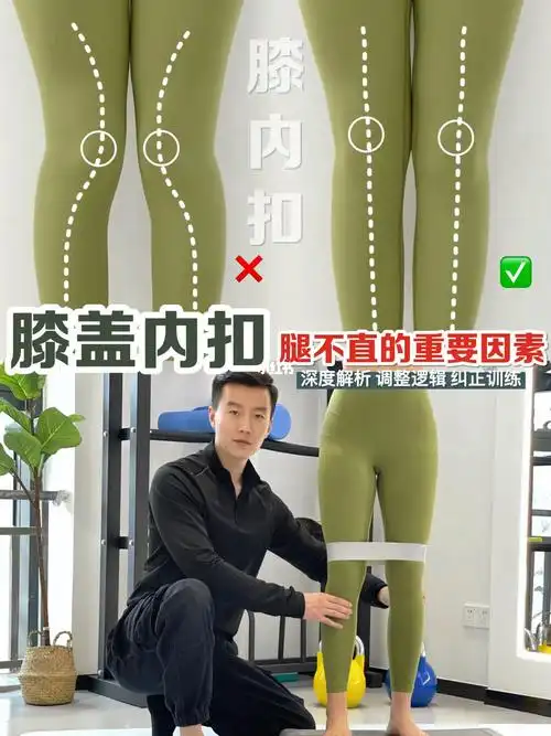 膝盖内扣腿不直的重要因素腿弯必练73