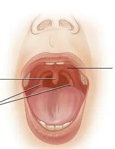 嘴里有一个小指母大小的东西 是什么?