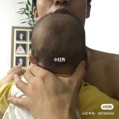 老师请您帮忙看一下我孩子的头型,现在孩子三个月25天,出生时因产道