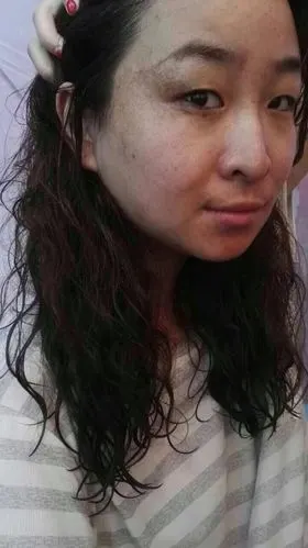 眼圈消失了,跟随我多年的脂肪粒也不见了,斑也跑的无影无踪,皮肤紧致