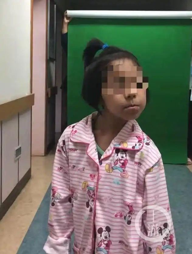 脖子一扭就无法复位家里出现歪头宝宝千万要注意