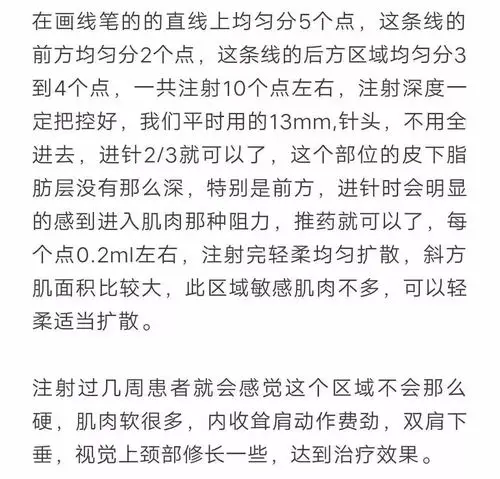 瘦肩针的注射方式,配比及风险