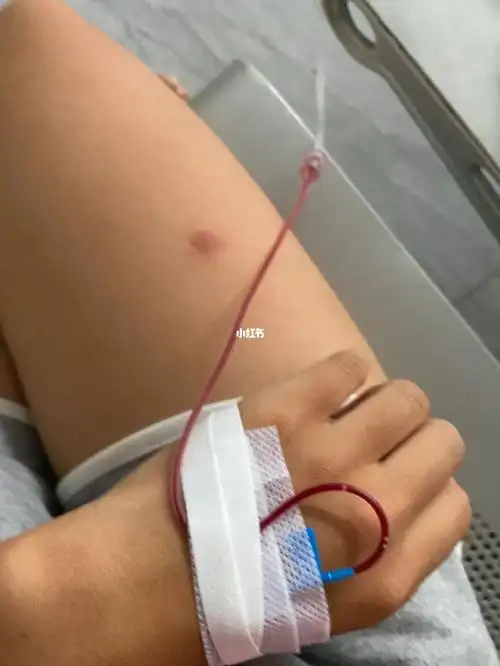 回血这种事咋在我身上发生呢