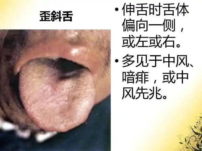 中医舌诊图片ppt