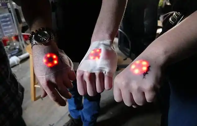 德国身体改造团体新玩法皮下植入led灯组图