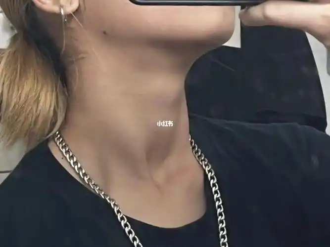 女生也可以有喉结吧