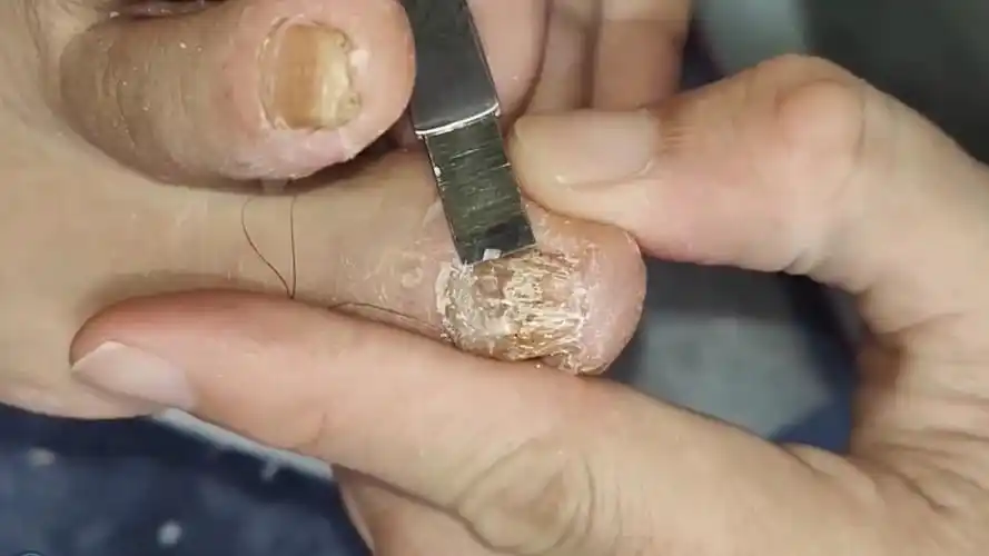 这个脚趾甲还是比较好一点的