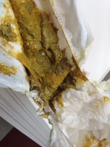 附图片一张是宝宝大便.