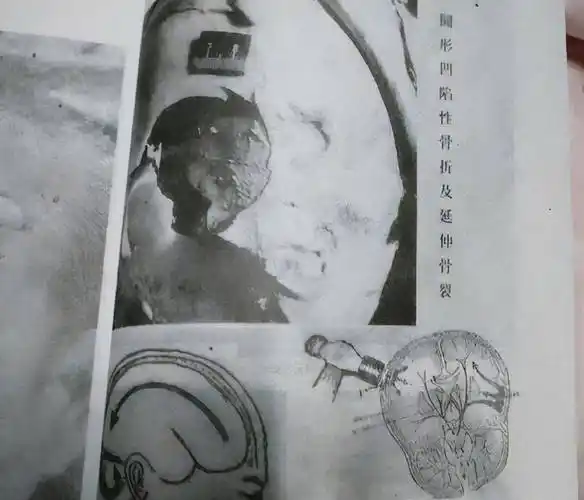 在学习法学相关知识的期间,她也不放弃申诉,法医两次对丈夫尸体进行