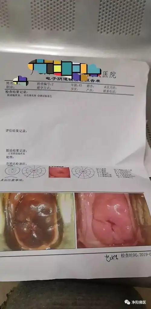 中药可让宫颈癌前病变和hpv病毒感染转阴