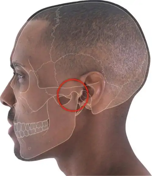 我的颞下颌关节紊乱病的治疗经历还是科维奇kovacs靠谱