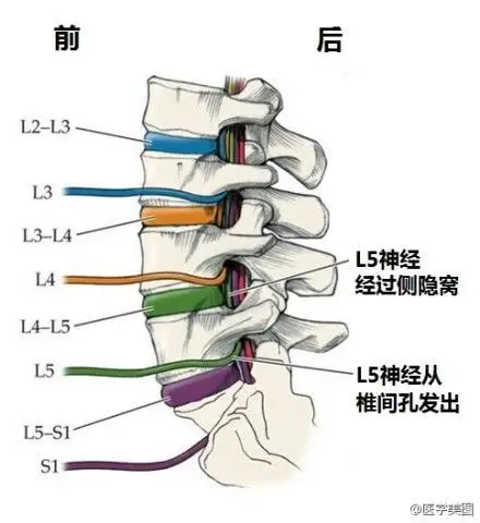 这张图可以解答许多人很纠结的一个问题:为什么l4-l5椎间盘突出是l5