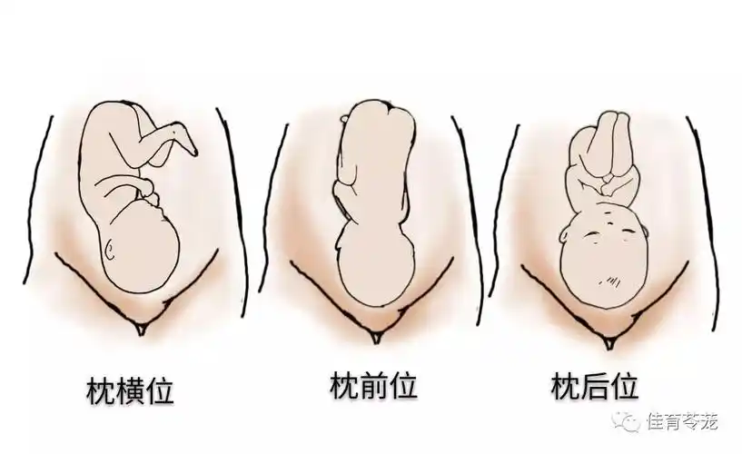 为"枕前位",这种位置能够让宝宝以ta头部最小的部分通过孕妈妈的骨盆