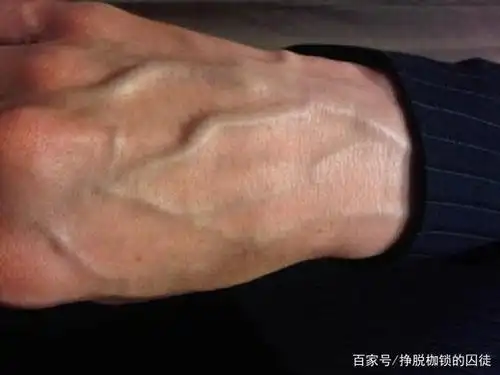 为什么有人手上的青筋凸起?这说明身体差吗?