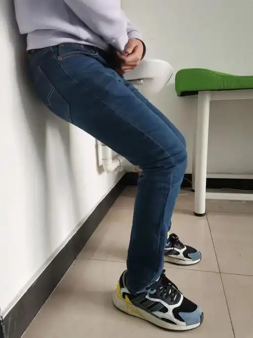 关于膝关节痛之髌骨软化综合症的康复治疗