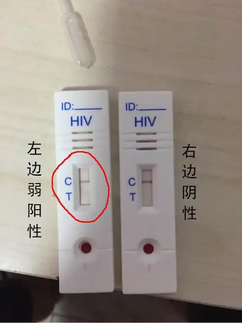 hiv初筛弱阳性的人多吗
