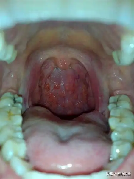 小孩嗓子老感觉有东西,老吭吭的怎么办? - 石塘网