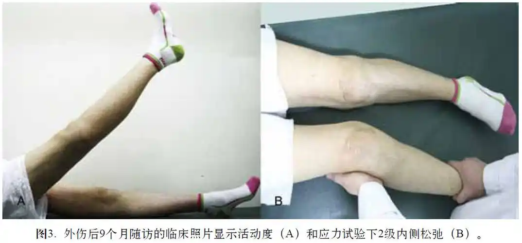 玉媛医院:接受膝关节置换术前面应该注意的问题