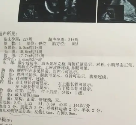 是一项重要的排畸检查在这个时候宝宝的各项器官已经发育得比较成熟了