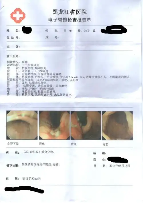 问:帮看一下怎么治疗 胃癌