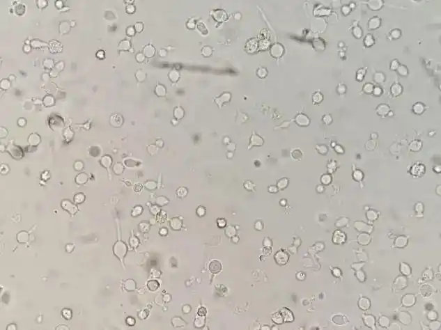 原来你是这样的l|细菌|细胞|镜检|白细胞|细胞壁_网易订阅