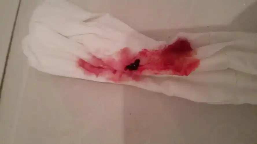 见红了什么时候生有图