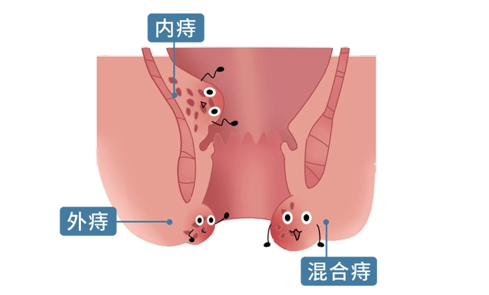 (男女都得看)_肛门
