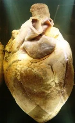 一匹伟大赛马的心脏-2008-2-22摄于澳国家博物馆