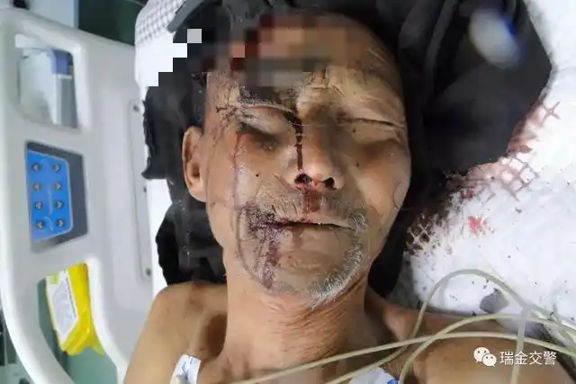 瑞金今天发生严重车祸,急寻死伤者家属