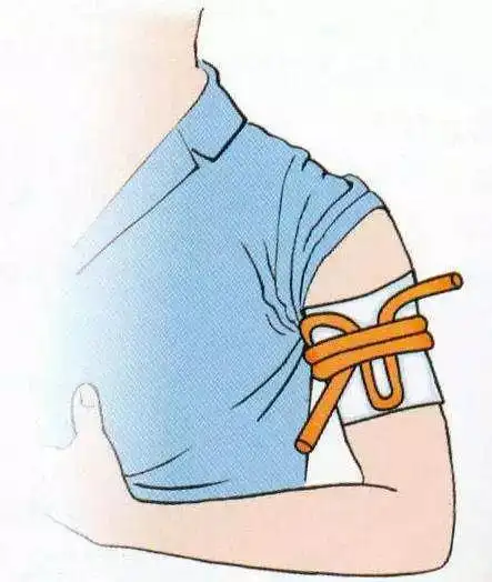 李时珍养生堂:各种外伤如何止血?六大方法收藏起来以备不时之需!_压迫