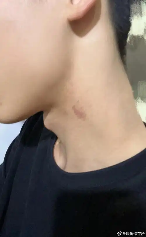 男朋友脖子上的是小草莓吗#龙年造梗大赛