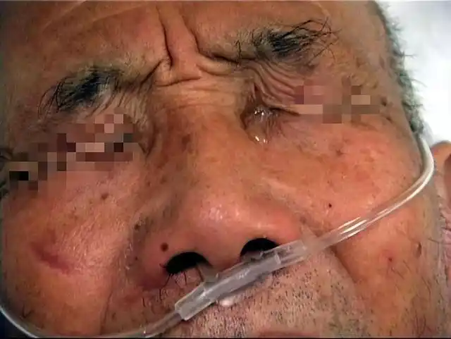 比如:有的人死后,由于自己最挂念的亲人不在身边,他死后还会睁着眼睛