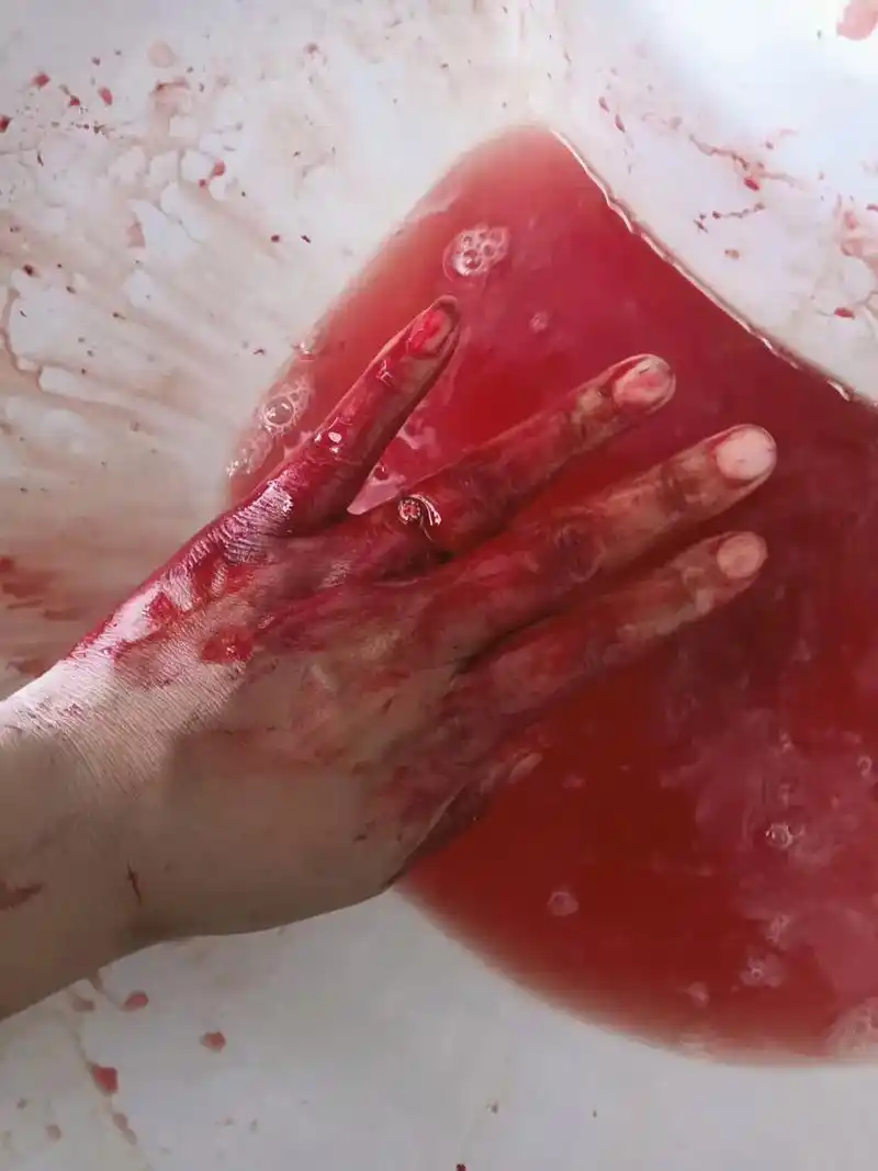 为什么受伤了会流血 ,因为你永远不知道明天和意外哪个先来 , - 抖音