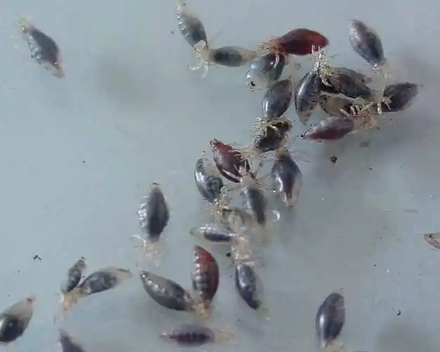 虱子图片,头上虱子图片