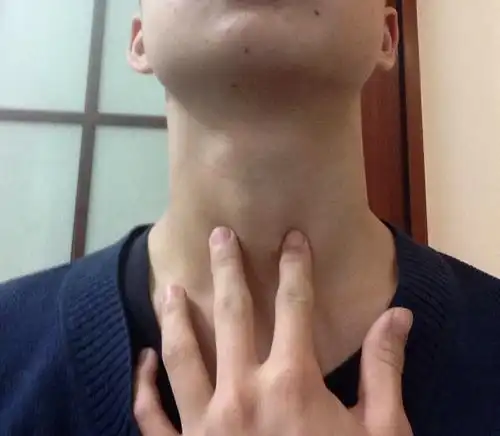 这样的喉结正常吗?(感觉比别人的大,好像