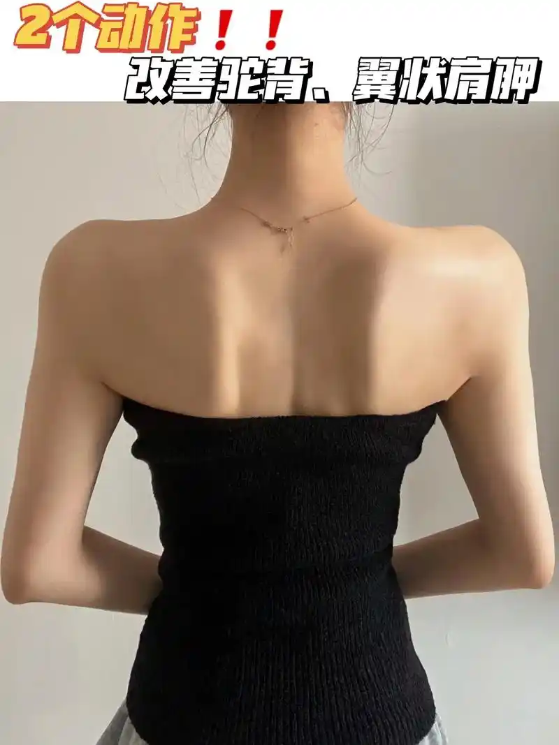 改善驼背翼状肩胛太厉害