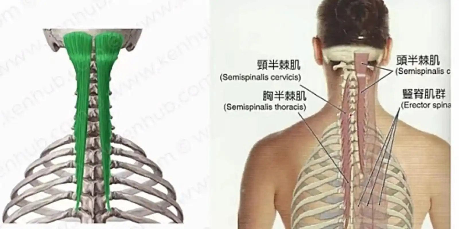 运动解剖【半棘肌 头前引,头痛相关肌肉】 1.