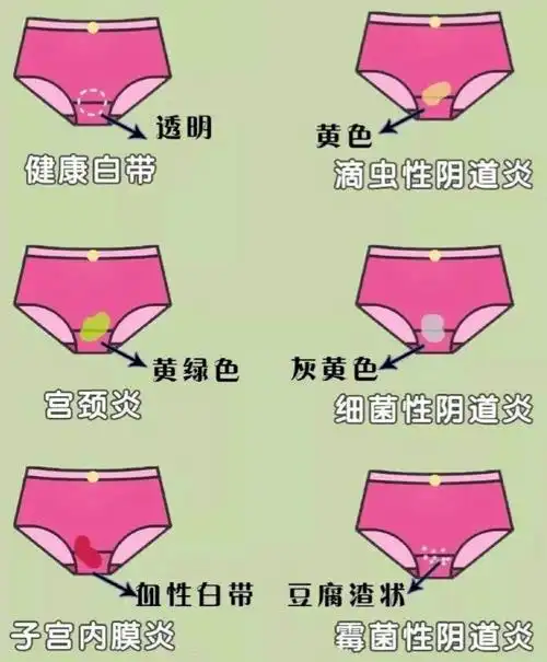 妇科炎症小知识