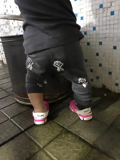 孩子一岁半走路罗圈腿老是不直请问医生这个需要到医院看吗