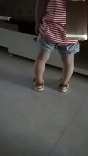 宝宝21个月,小腿有点弯曲,半年前去医院拍了片子,医生说没事,现在还是