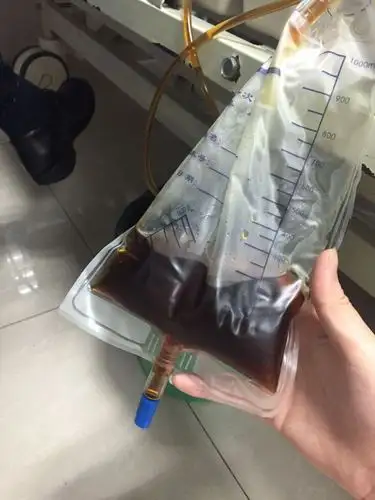 很久没运动去健身房大量力量训练后发现尿液是酱油色