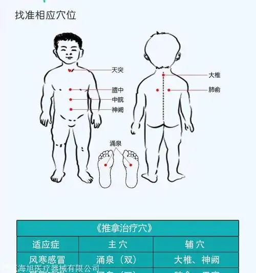 小儿保健贴小儿穴位敷贴儿童感冒健脾消食咳嗽贴小儿贴厂家