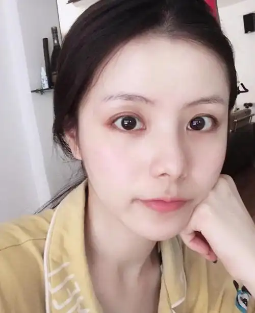 但是无论是化妆或者医美都是后天努力的,有些女生天生就有这4个"特征"