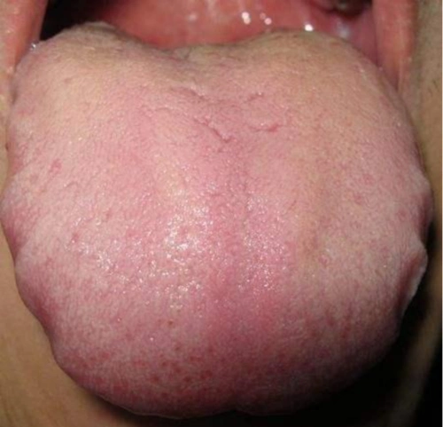 你的心脏好不好,这几种症状已经说明了一切!