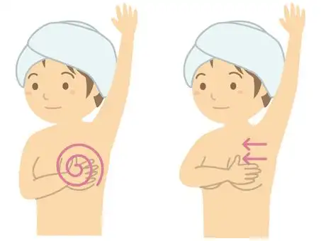自我检查乳腺癌,肿块