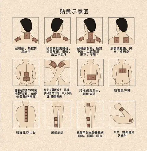 蕲艾春艾灸贴热灸贴无烟艾女士暖宫贴理疗贴颈椎热敷温灸贴痛经贴