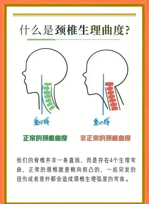 颈椎曲度变直?3个简单方法教你改善!